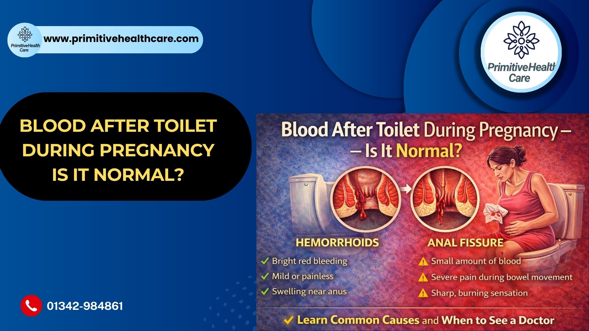 Blood After Toilet During Pregnancy – Is It Normal?